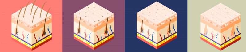 ليزر بيورير