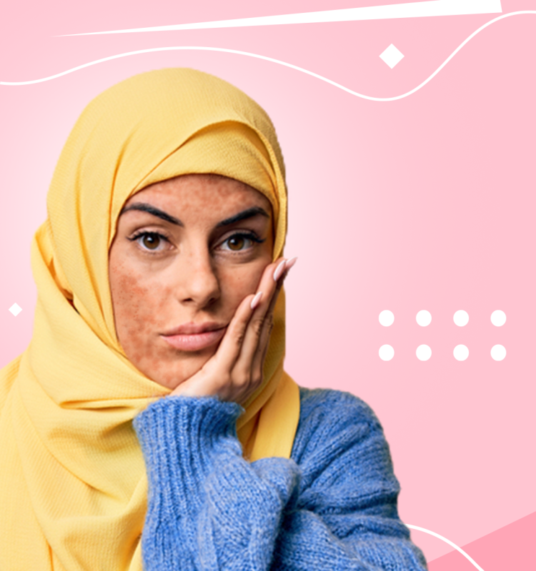 جربت كل منتجات الوجه وما فيه شي نفع معي، الحين عرفت ليش! جربت كل منتجات الوجه وما فيه شي نفع معي، الحين عرفت ليش!